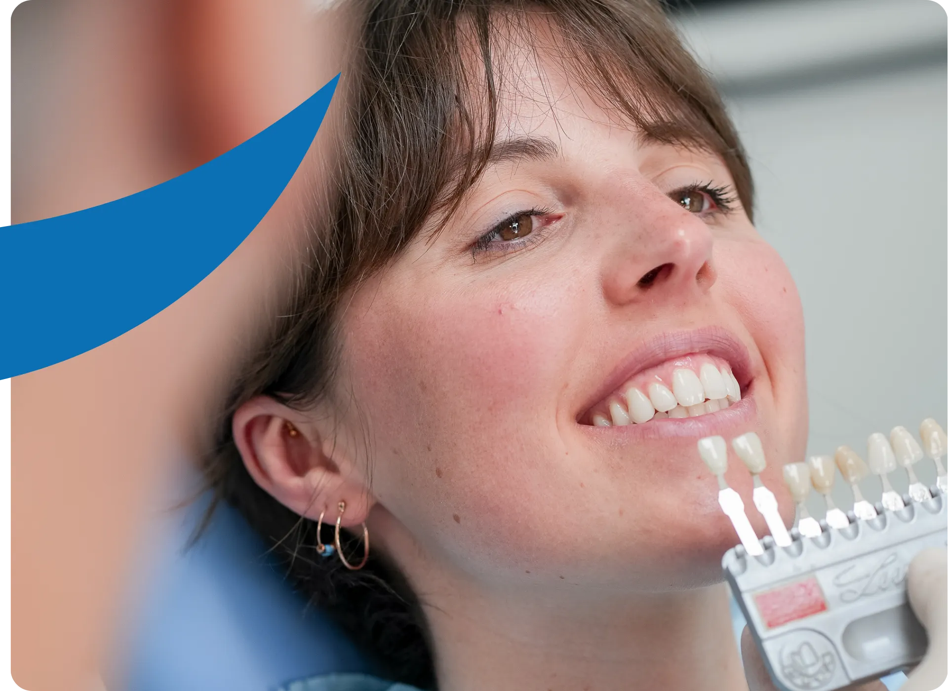 CORE 3 Faccette Dentali a Schio 1